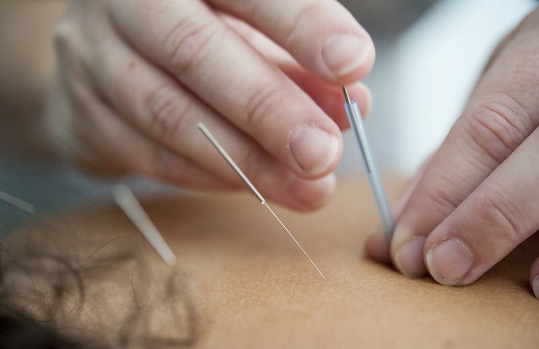What Is Traditional Chinese Medicine and How Can It Help You?
